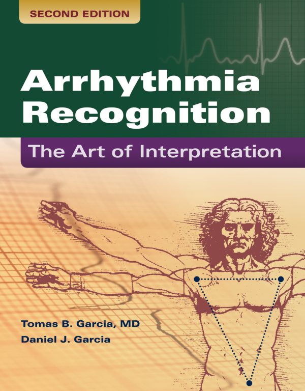 Arrhythmia Recognition The Art of Interpretation 2nd 2E Edition