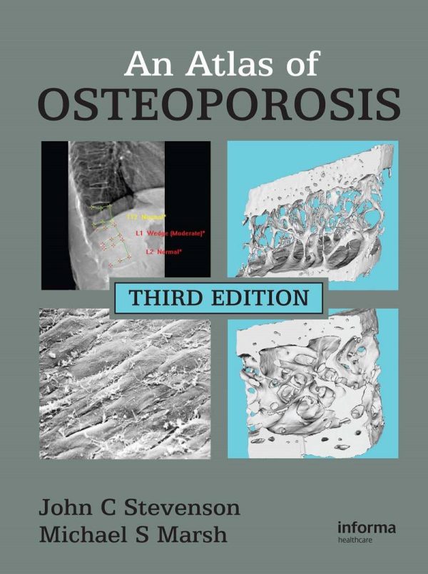 An Atlas of Osteoporosis 3rd 3E Edition