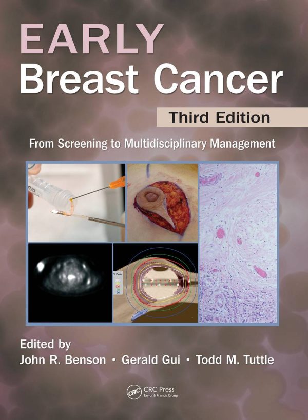 Early Breast Cancer From Screening to Multidisciplinary Management 3rd 3E Edition