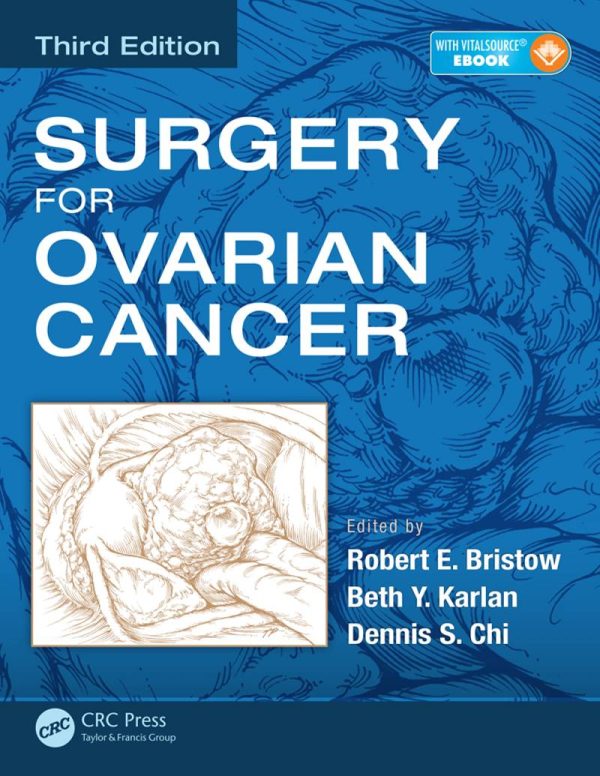 Surgery for Ovarian Cancer 3rd 3E Edition